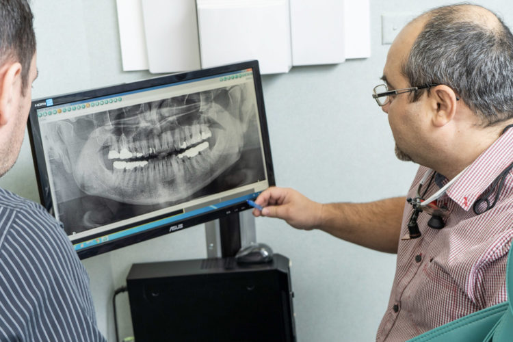 Oral scan in West Island